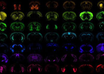 «Google для мозга»: учёным открыли единую ИИ-систему для сравнения неврологических заболеваний